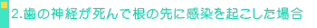 2.̐_oō̐ɊNꍇ
