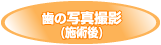 ̎ʐ^Bei{pj